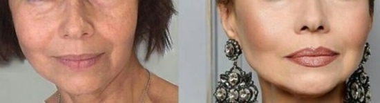 04-labios-com-rugas