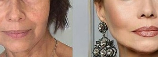 04-labios-com-rugas