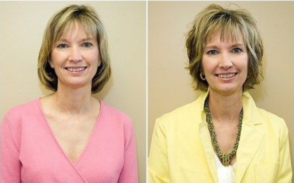 15 Transformações : ANTES e DEPOIS de corte de cabelo
