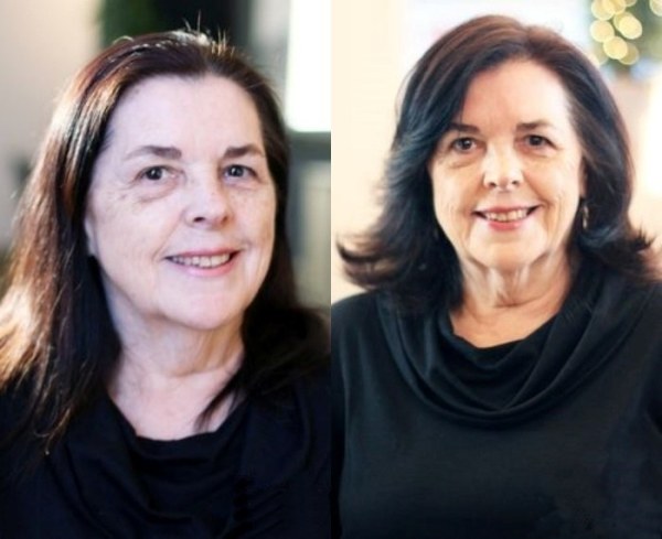 Bem na foto: 17 cortes de cabelos antes e depois