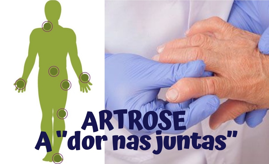 O que é artrose - a dor nas juntas
